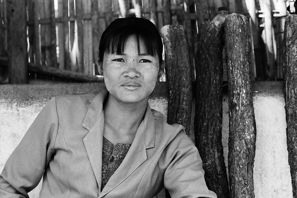 Woman With A Strained Look (Myanmar)