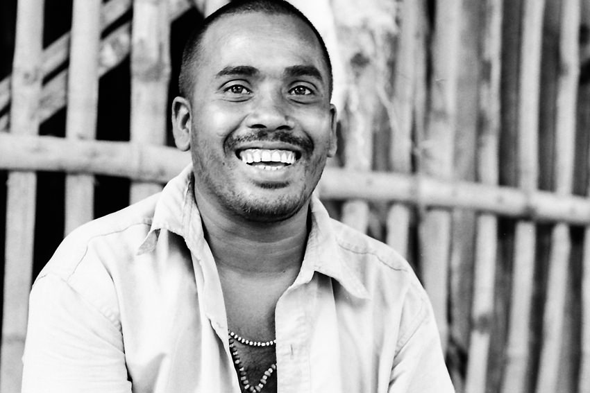 Man laughing while showing white teeth