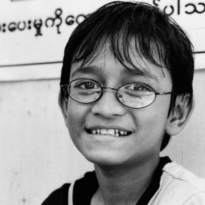 Boy with double teeth